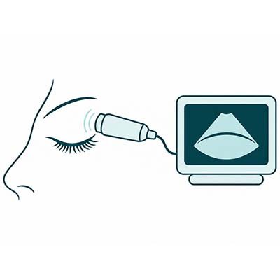 Ecosonografía ocular